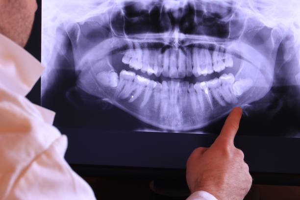 Best Walk-In Emergency Dental Services in Glen Alpine, NC